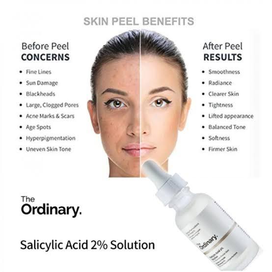 The Ordinary - Salcilic Acid 2% Anhydrous Solution - PREMIUM PICKS